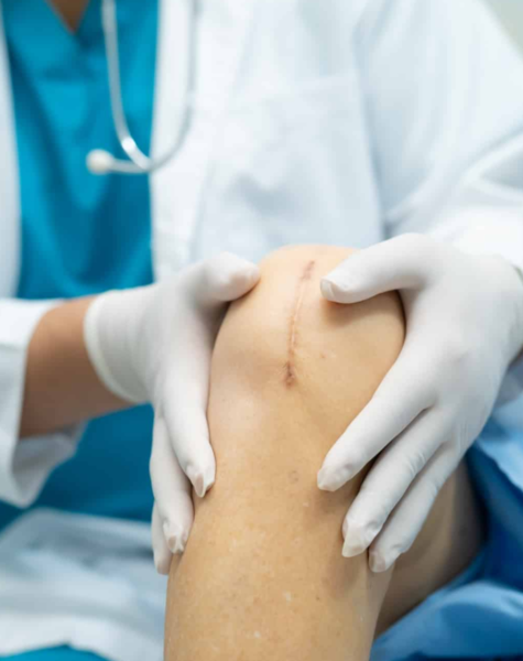 Joint Replacement (Hip & Knee)