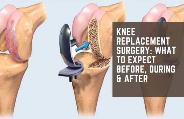 Knee Replacement Surgery_ What to Expect Before, During & After
