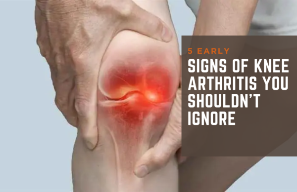 5 Signs of Knee Arthritis You Shouldn't Ignore