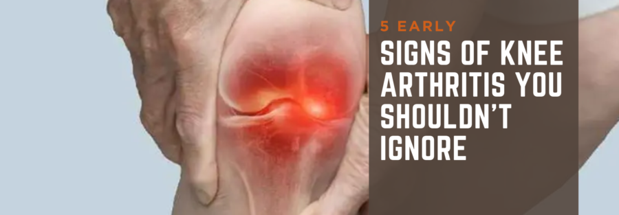 5 Signs of Knee Arthritis You Shouldn't Ignore